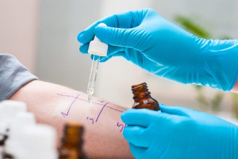Understanding Allergy Tests: A Guide to Food and Environmental Allergies in Singapore