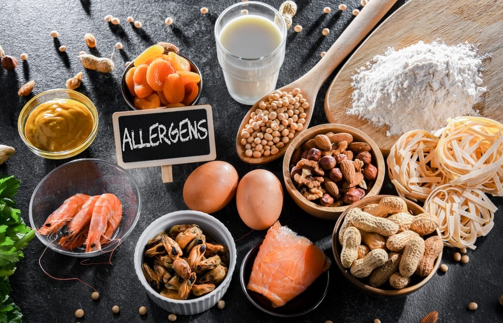 Food Allergens