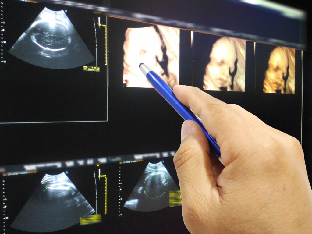 3D and 4D Ultrasound