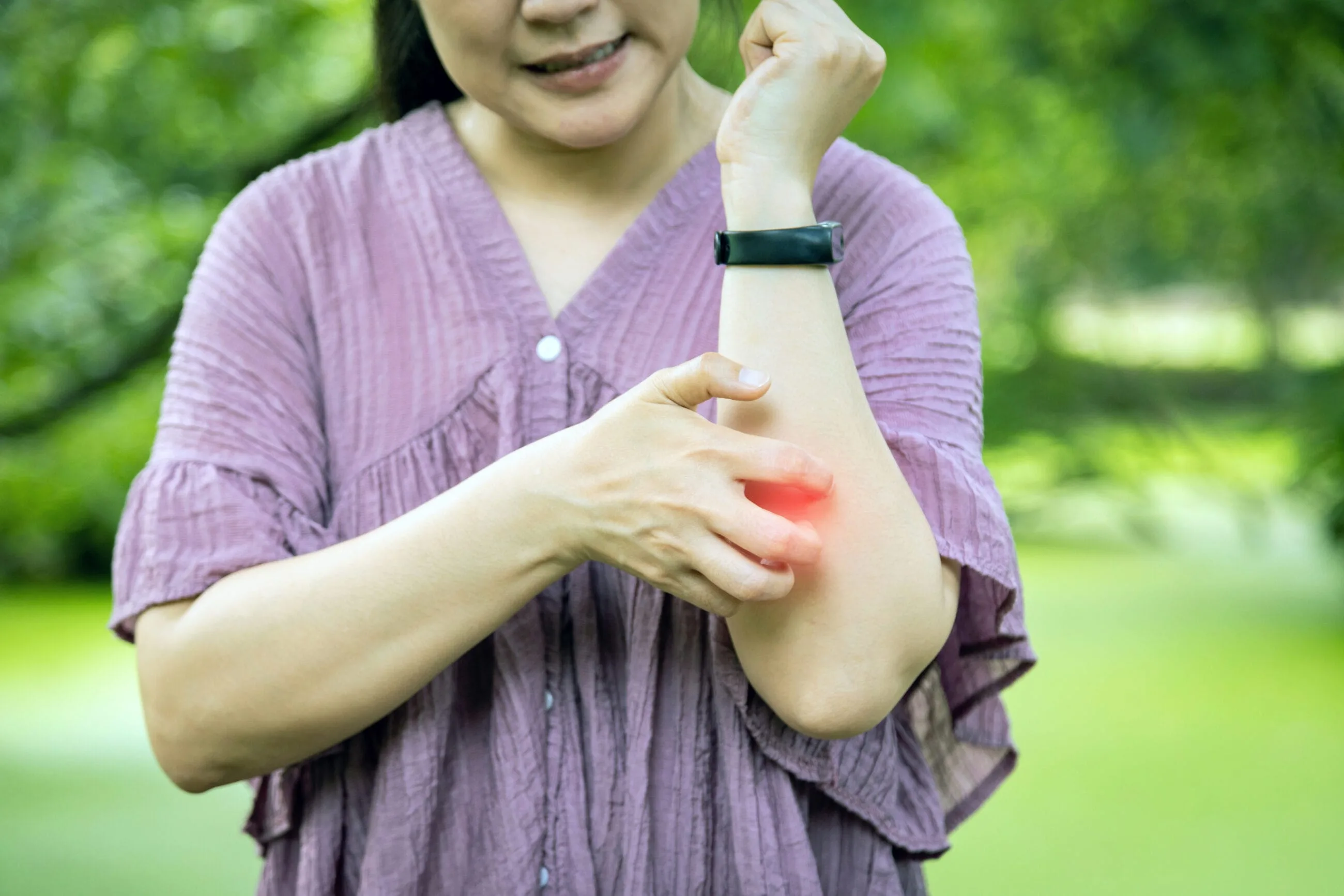 Recognizing Allergy Symptoms: From Skin Reactions to Anaphylaxis