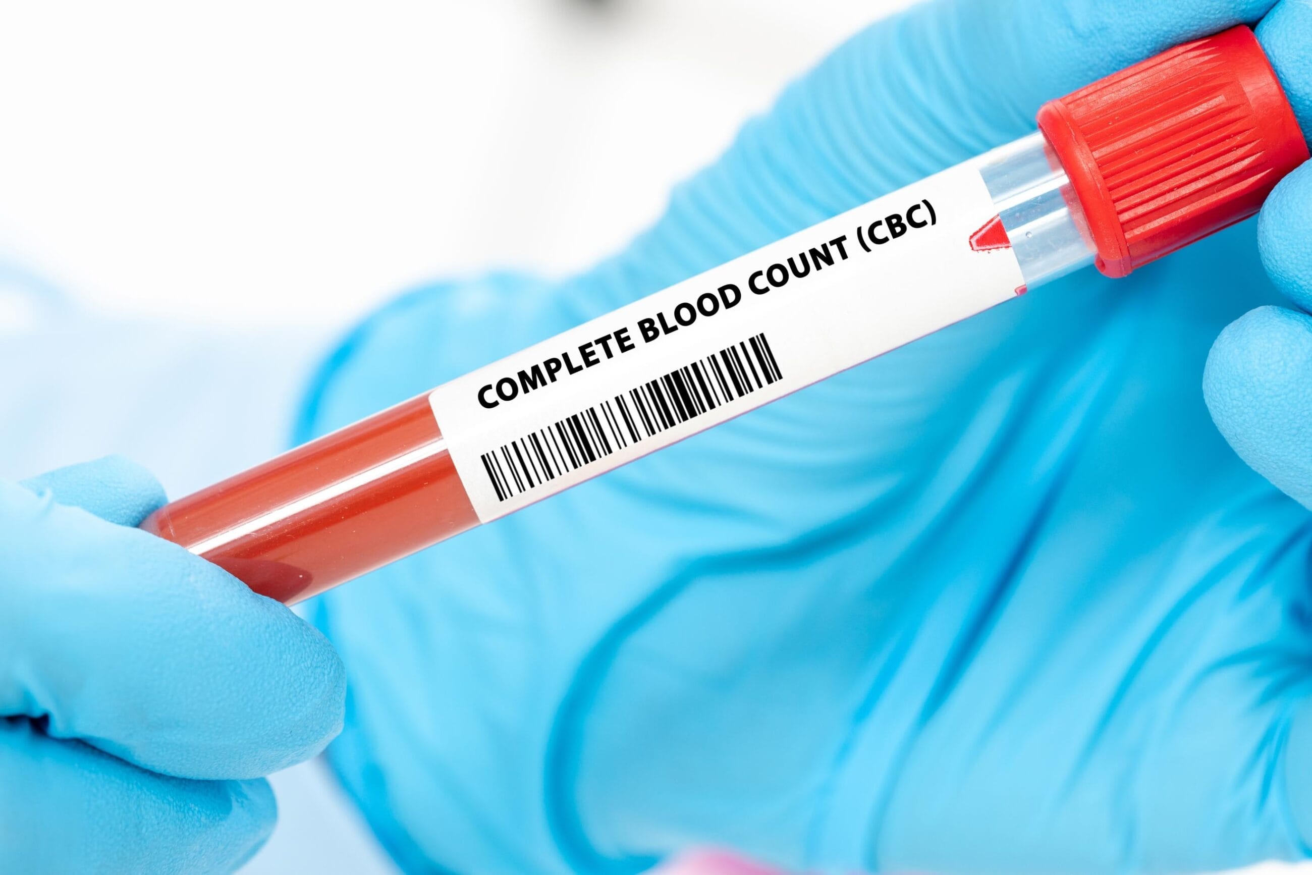 Complete Blood Count (CBC)