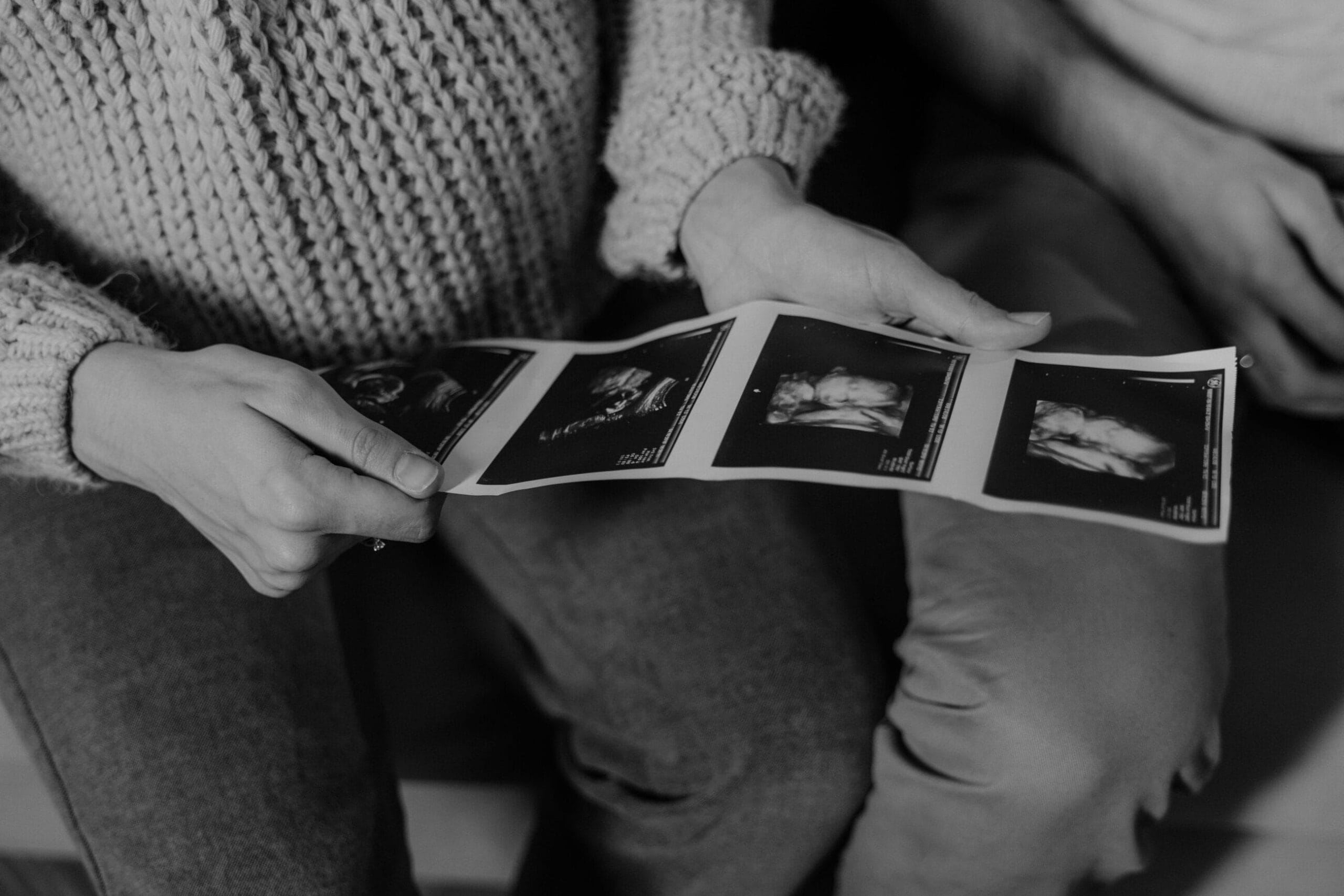 Conventional Ultrasound