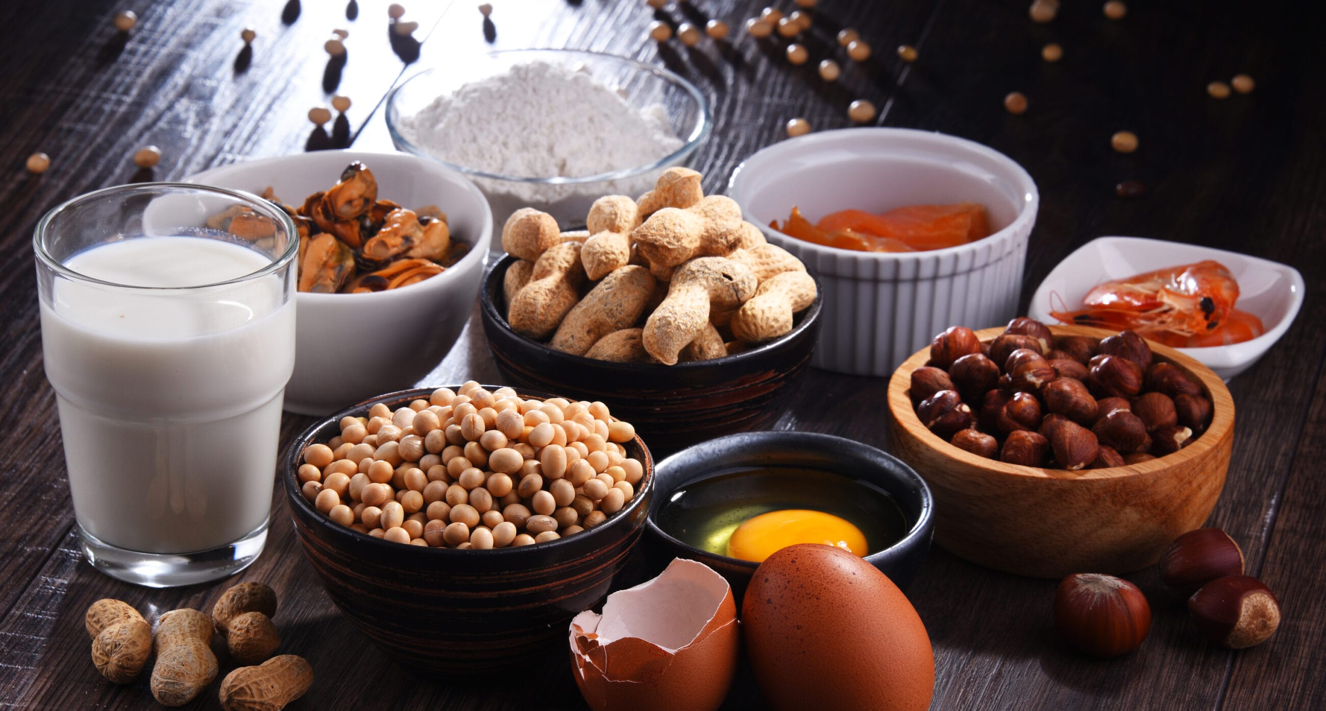 Food Allergies The Basics