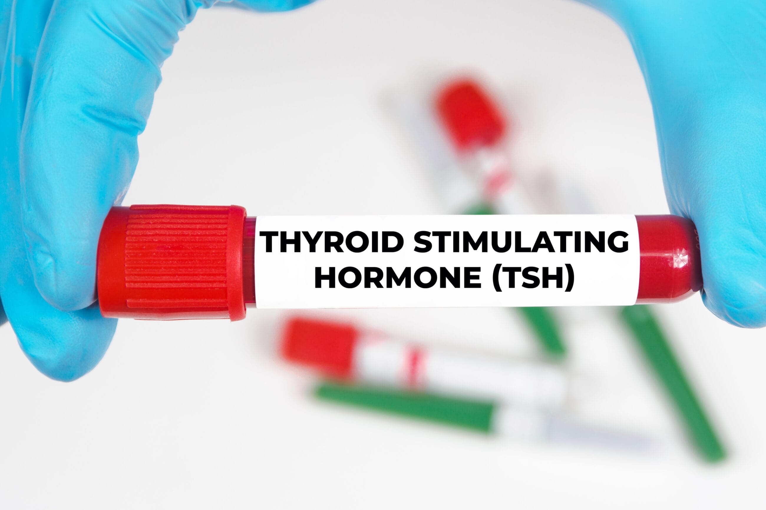Thyroid Function Test