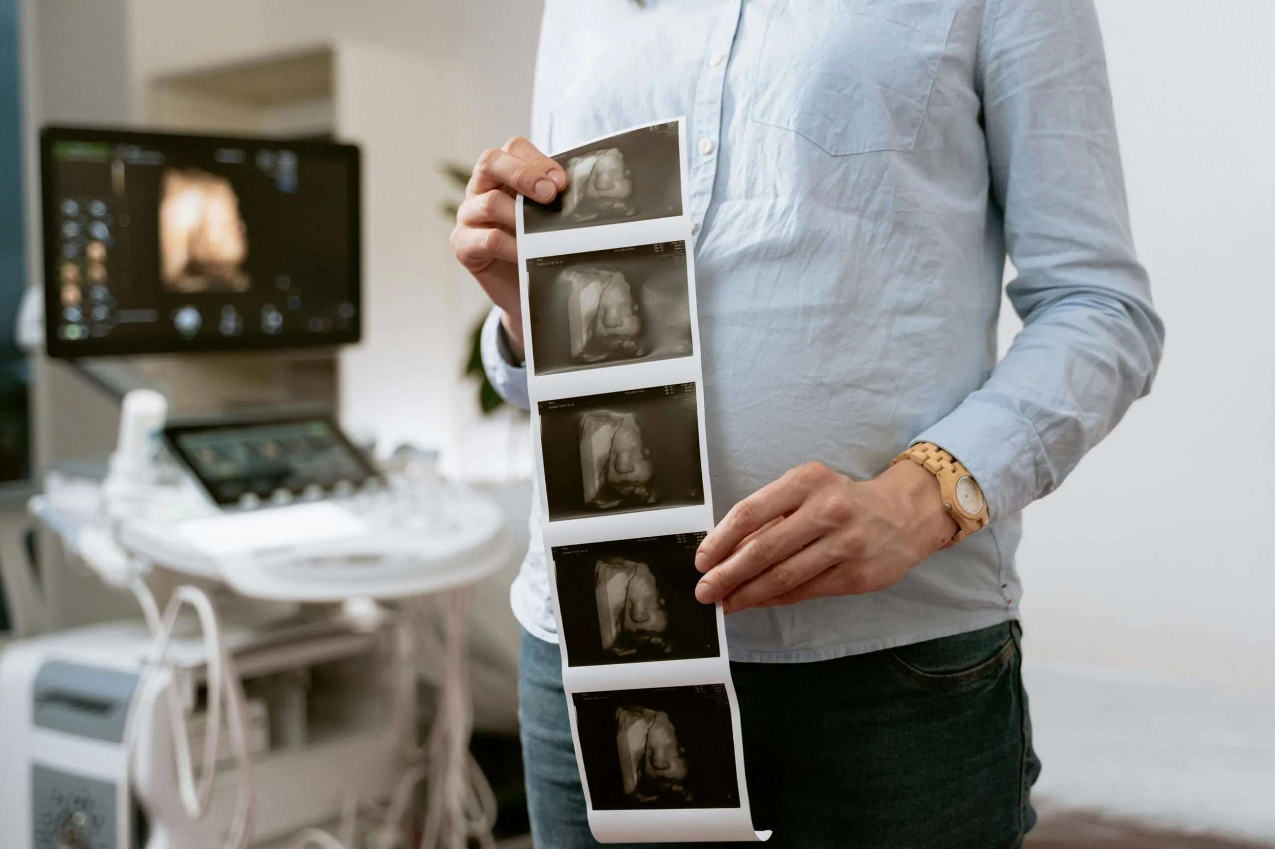 Ultrasound Imaging: Different Types and Their Uses in Medical Diagnosis