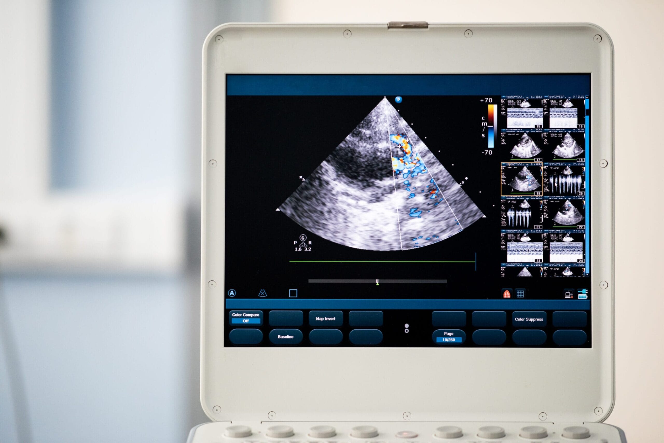 What Is Ultrasound Imaging