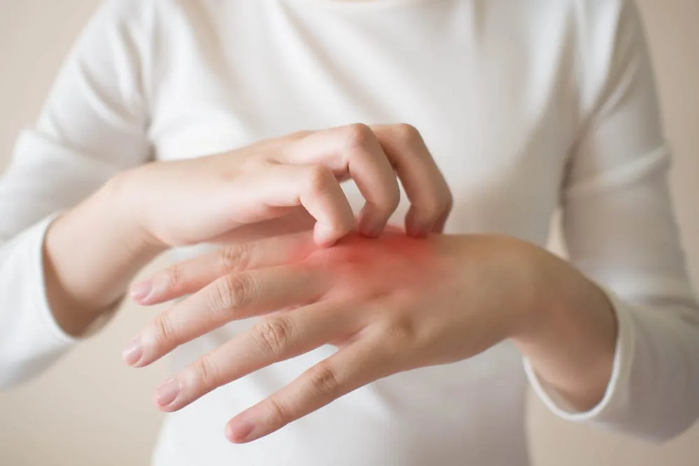 Living with Allergies: Long-term Management and Finding Support