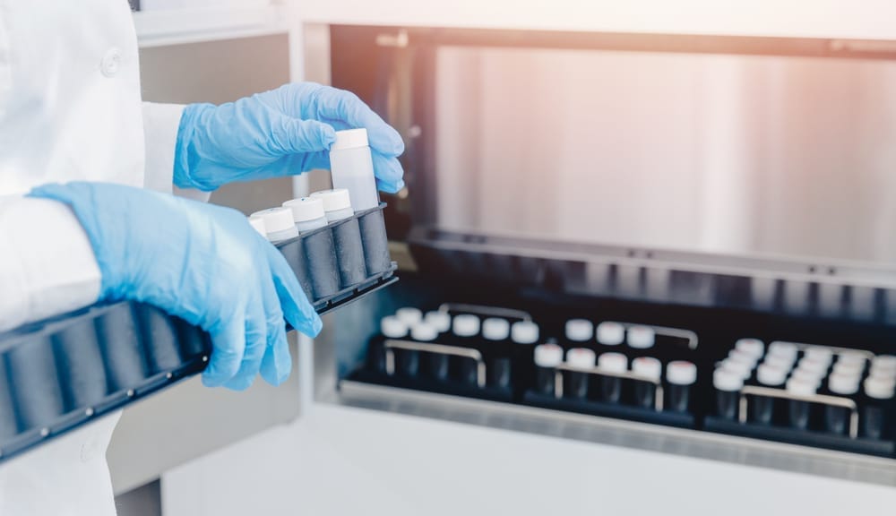 Nucleic Acid Test (NAT)