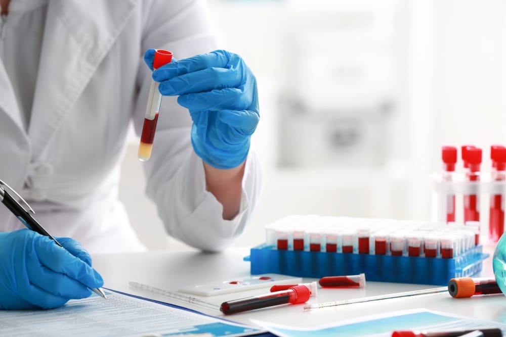 What Is an IgE Allergy Blood Test?