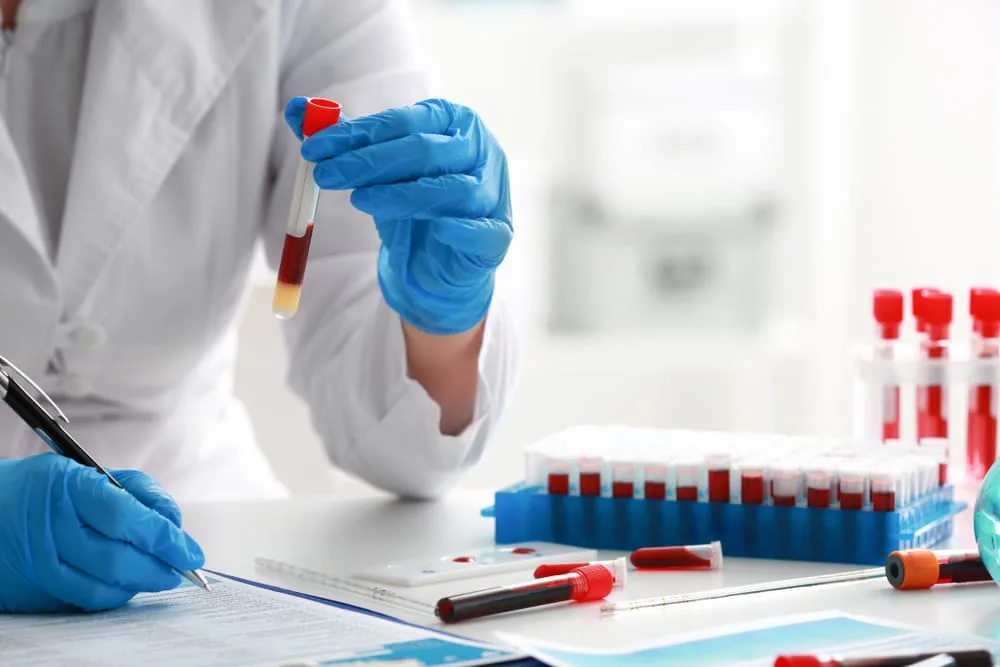 What Is an IgE Allergy Blood Test?