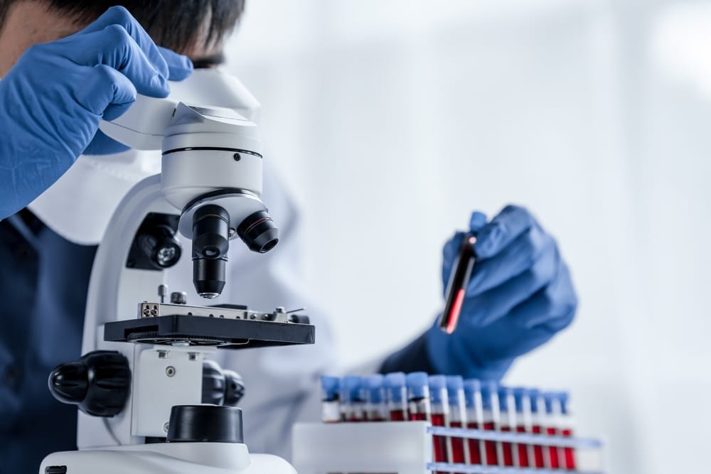 Interpreting Sodium Blood Test Results