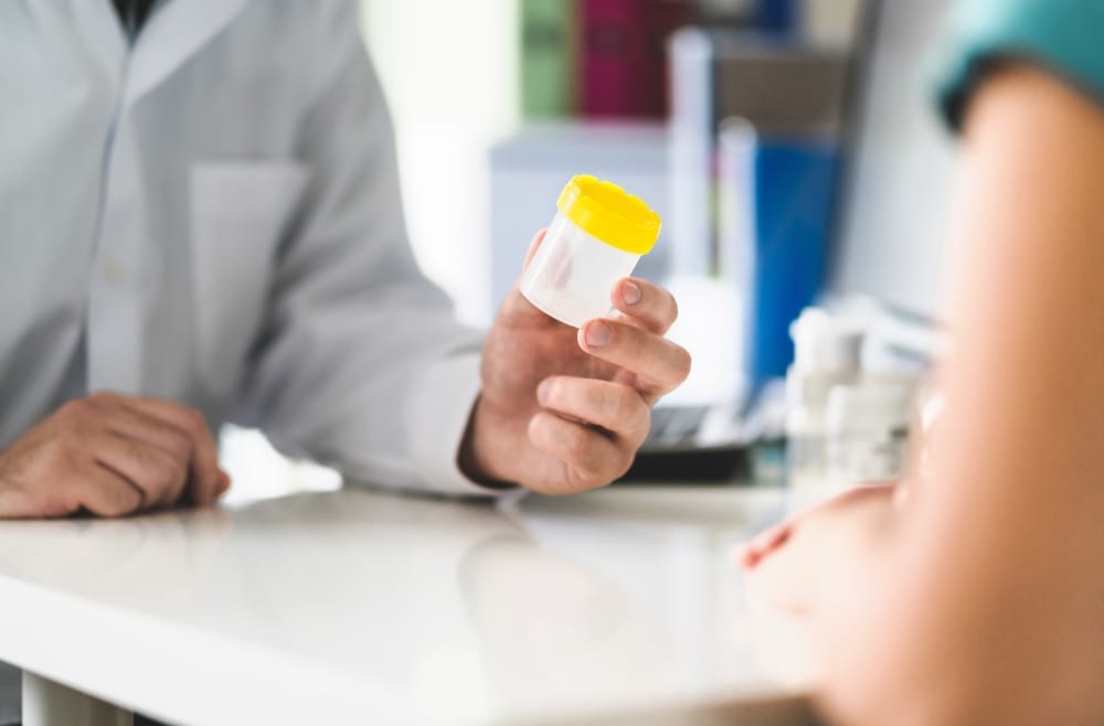 Urine and Stool Tests