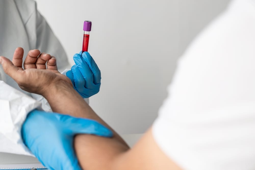 When Should You Have HIV Test