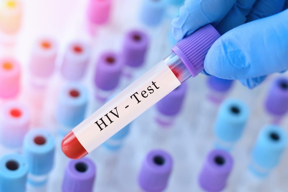 When to Get Tested In Human Immunodeficiency Virus