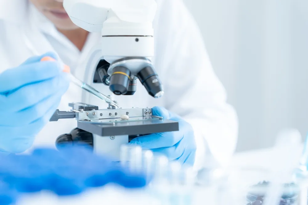 Understanding SGOT Levels What High or Low Results Mean