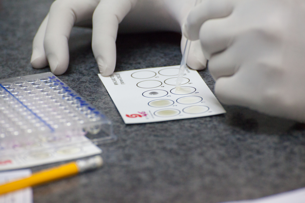 VDRL syphilis screening