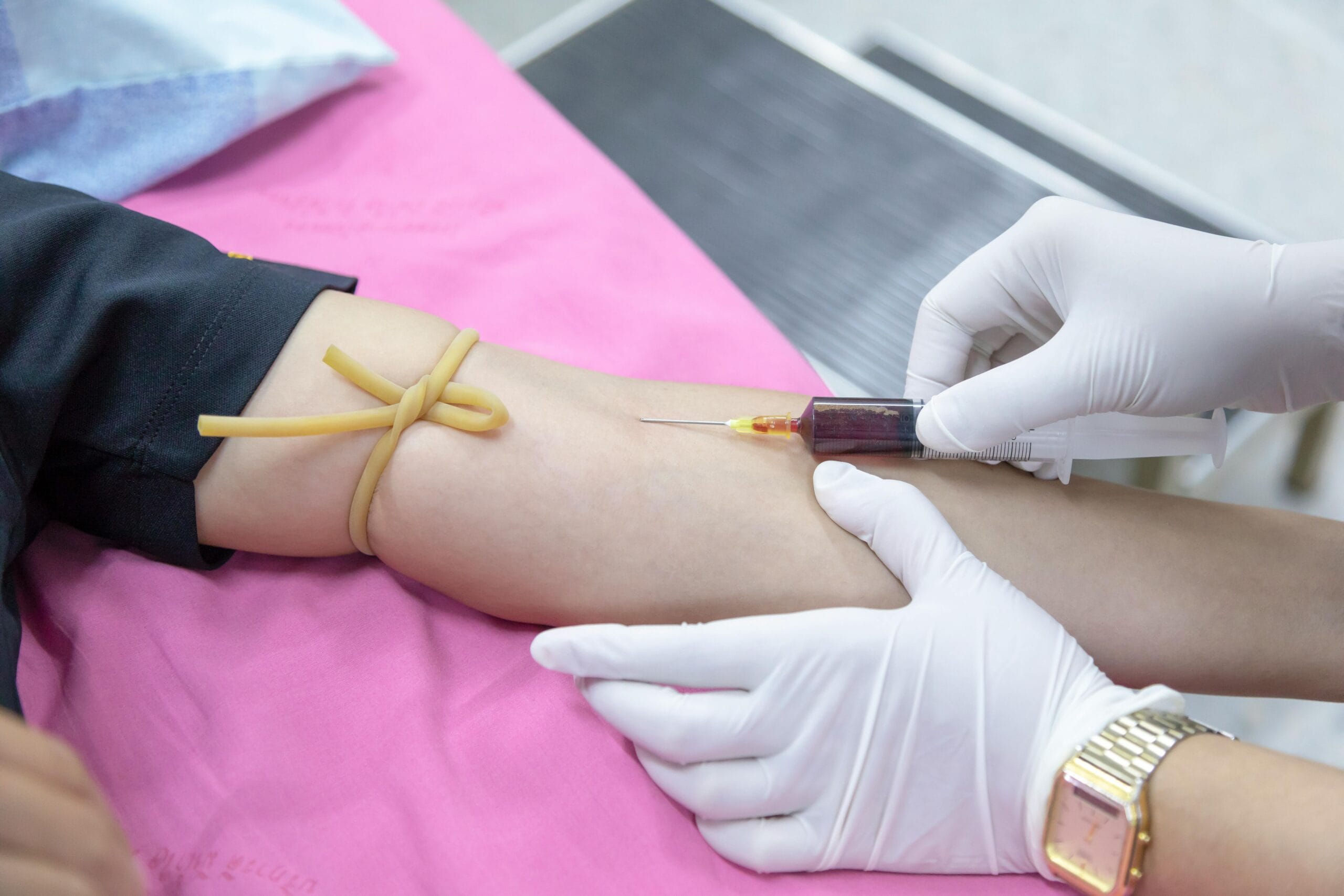 The Vitamin D Test Process