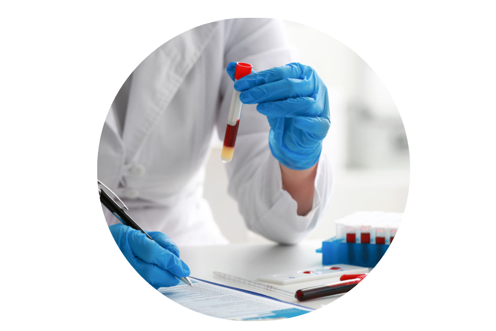 http://Measles%20Serology%20Test