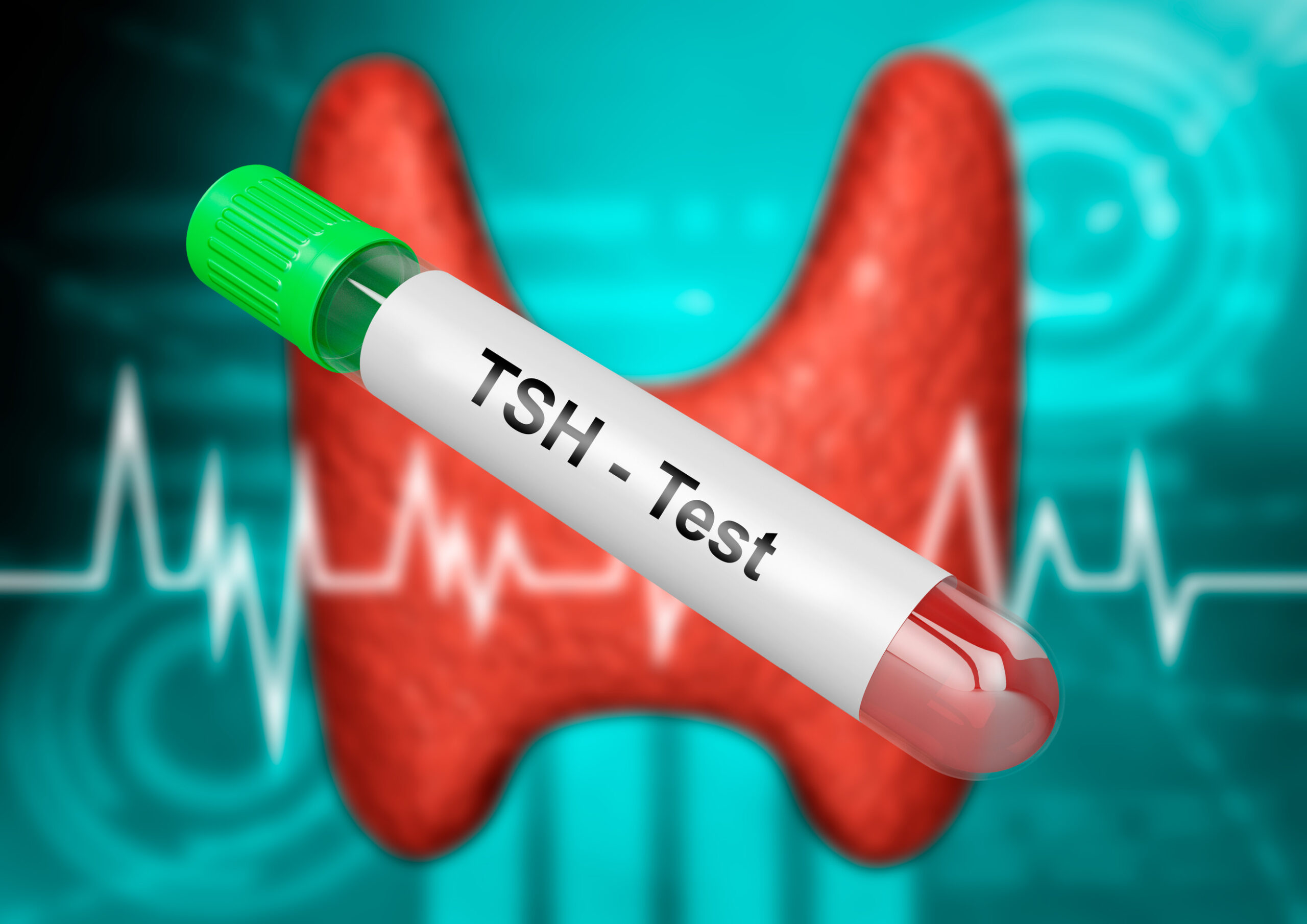 Thyroid Stimulating Hormone (TSH)