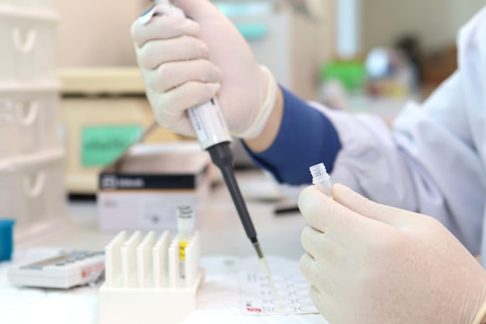 Why Is Stool Analysis Important for Overall Health