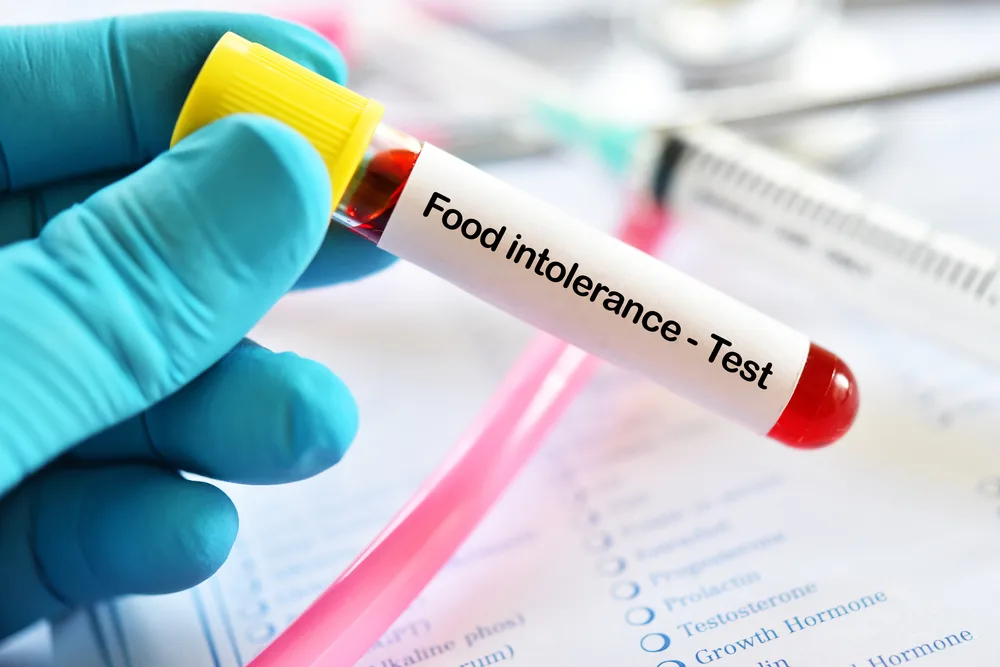 Types of Food Intolerance Tests Available in Singapore
