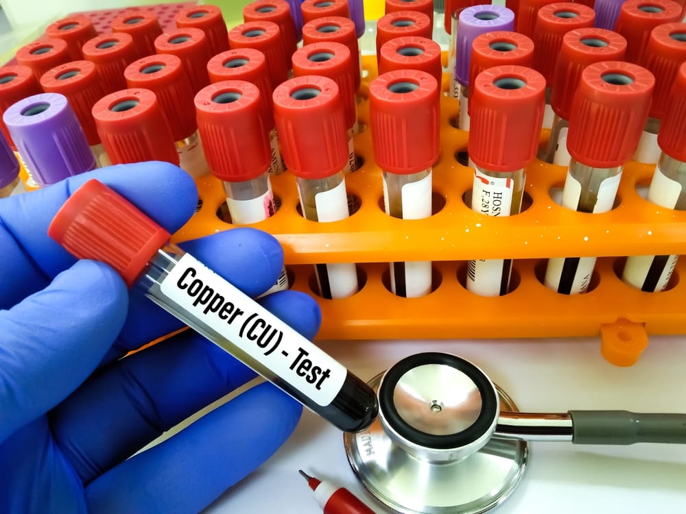 Understanding Copper Deficiency and Toxicity