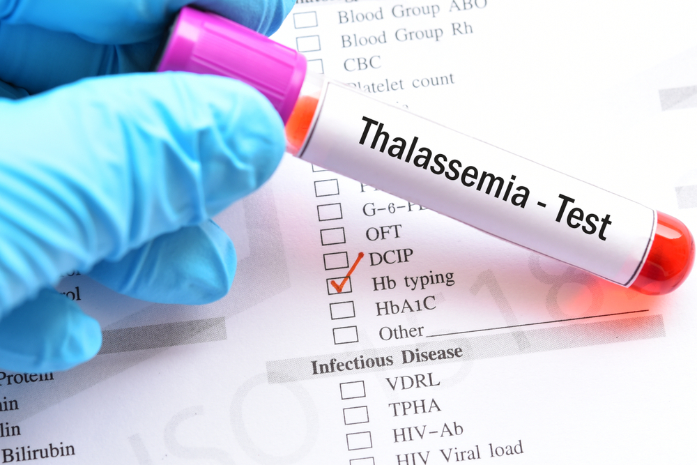 Understanding Thalassemia in Singapore