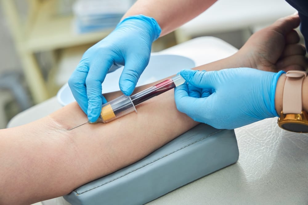 Vitamin E Testing Options in Singapore