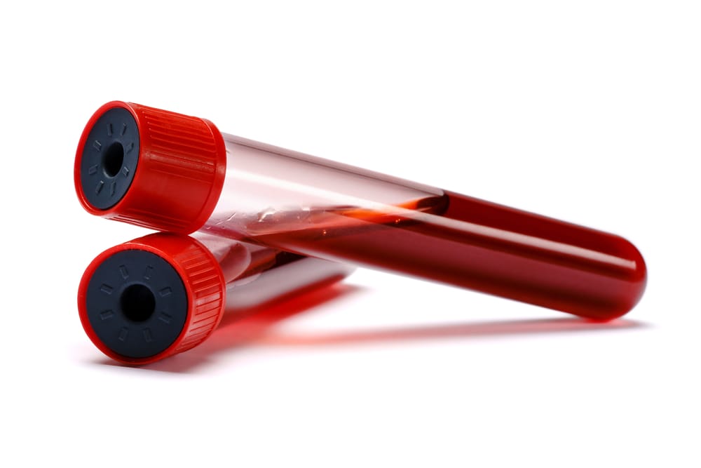 What Are Infertility Blood Tests