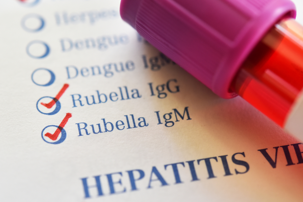 Understanding the Rubella Immunity Blood Test