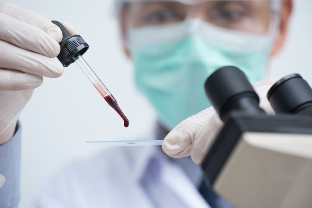 Why is Early Lupus Screening Important