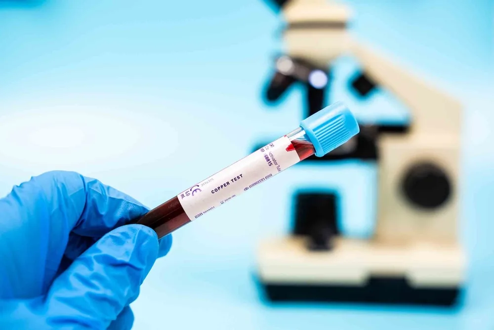 Copper Blood Test: Detecting Wilson’s Disease and More