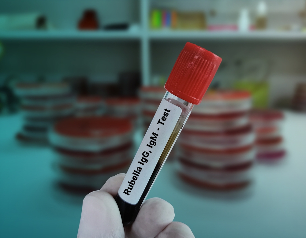rubella immunity blood test Singapore