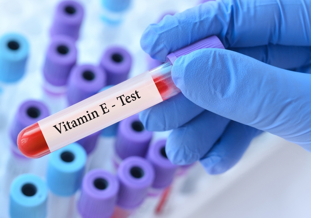 vitamin E deficiency test Singapore