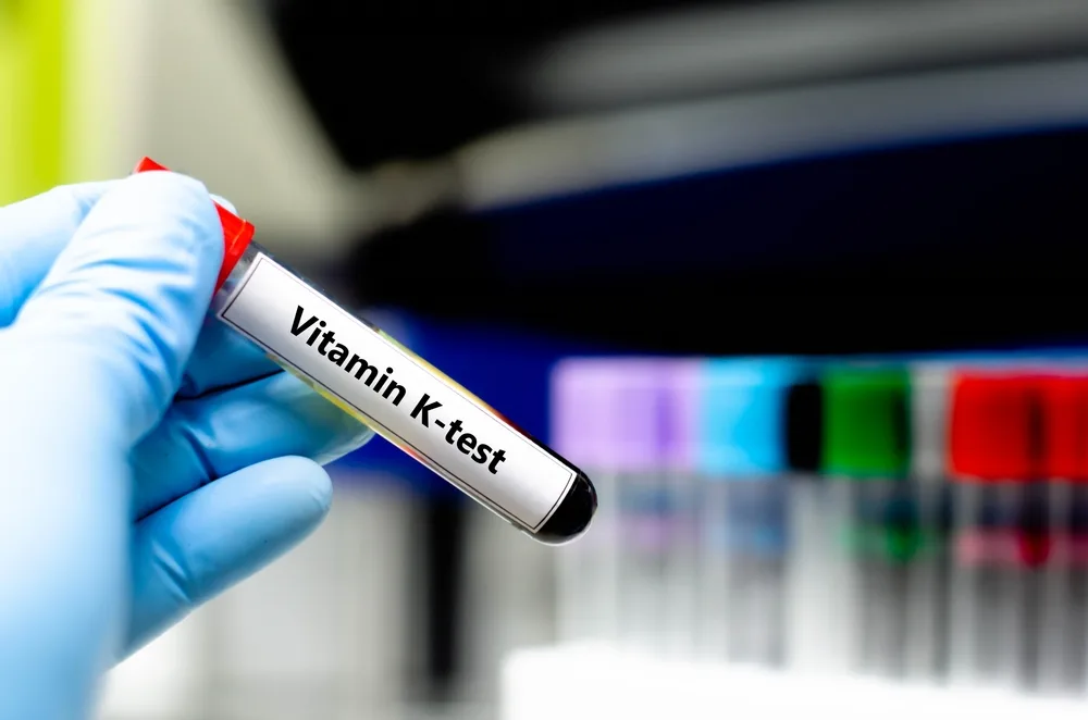 Vitamin K Deficiency: Why It’s Rare But Important to Check